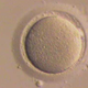 Illustration for article titled New vitrification technique allows women to freeze their eggs for future use